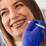 ORTODONCIA CON BRACKETS CONVENCIONALES