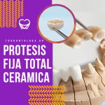 CORONAS TOTAL CERAMICAS
