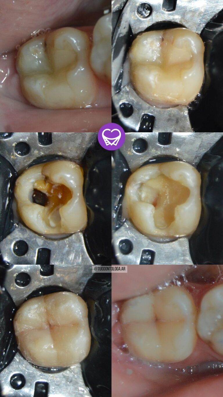 UD 37 TUODONTOLOGA.AR