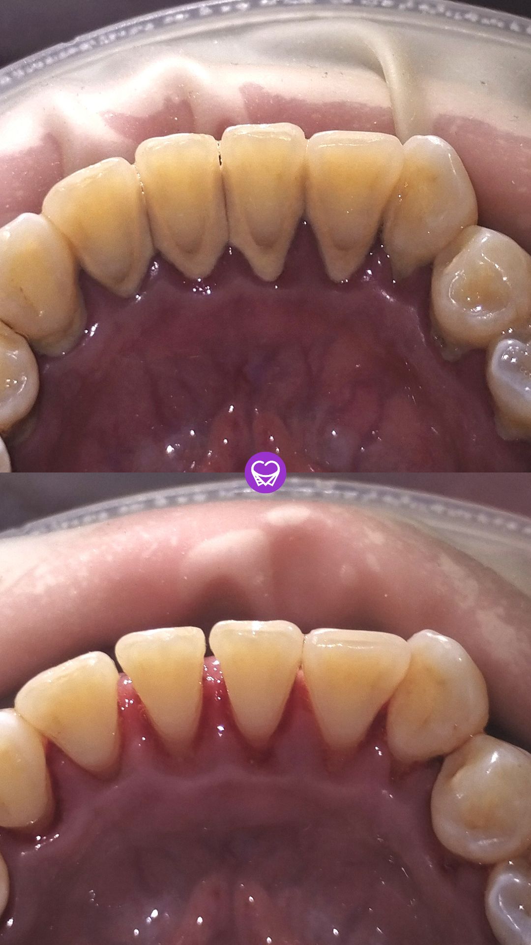 limpieza tuodontologa.ar