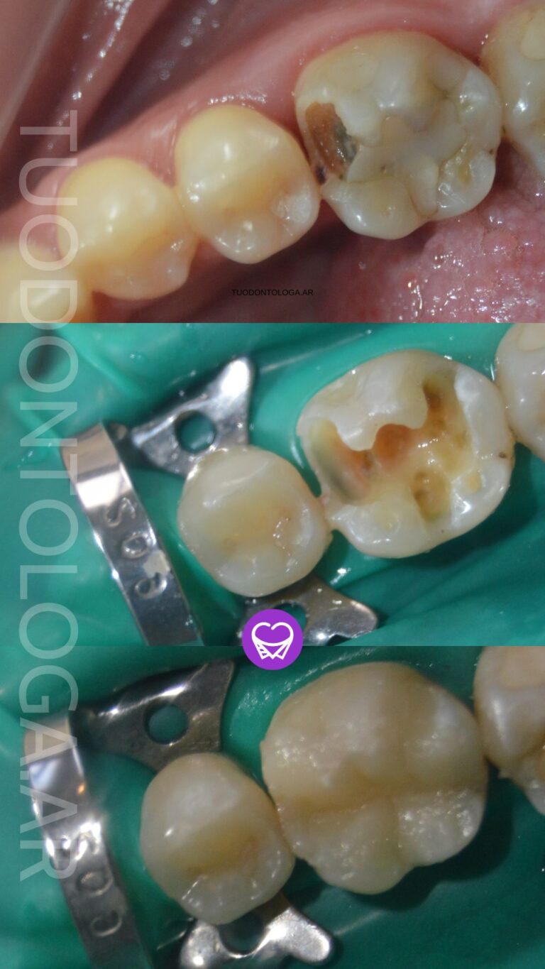 restauracion tuodontologa.ar