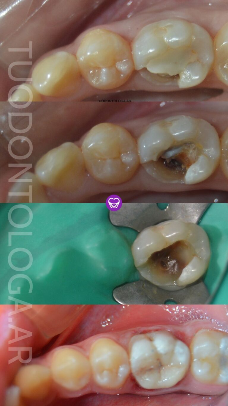 restauraciones tuodontologa.ar